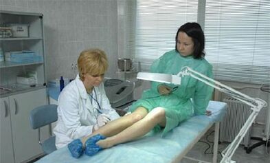 ako liečiť kŕčové žily na nohách